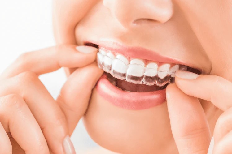 Orthodontic Care